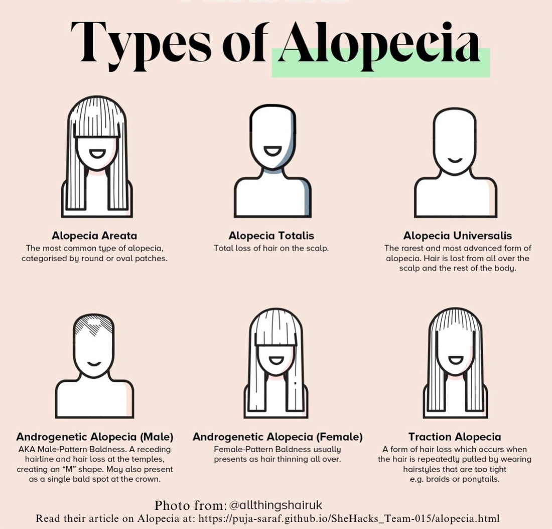 What Is Alopecia? Understanding Hair Loss, Causes, and Solutions
