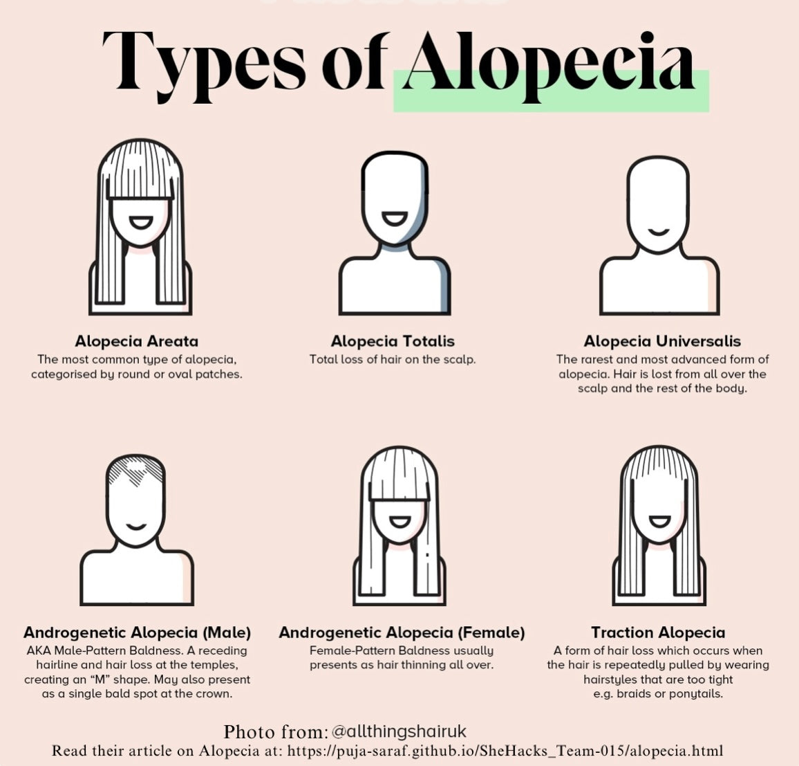 What Is Alopecia? Understanding Hair Loss, Causes, and Solutions